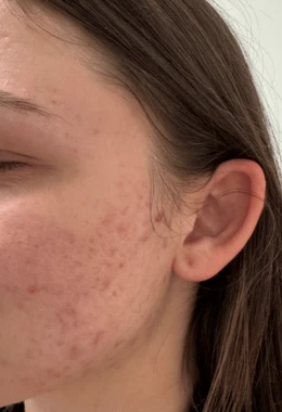 Gabriela application.metamorphosis.after